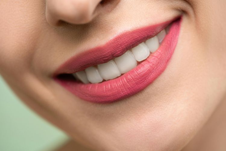 new smile