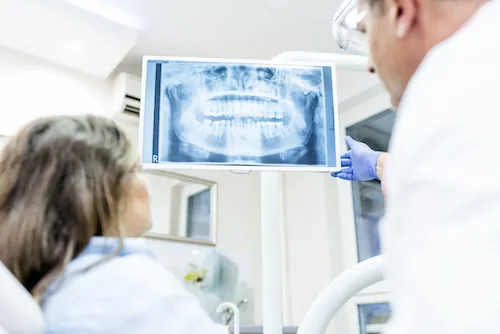 Digital Dental X-Ray in Tennessee at Martin Dentistry